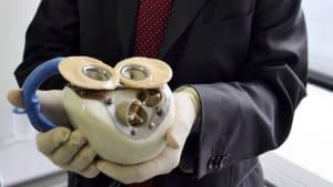 Carmat's second patient dies 9 months after receiving an Artificial Heart implant