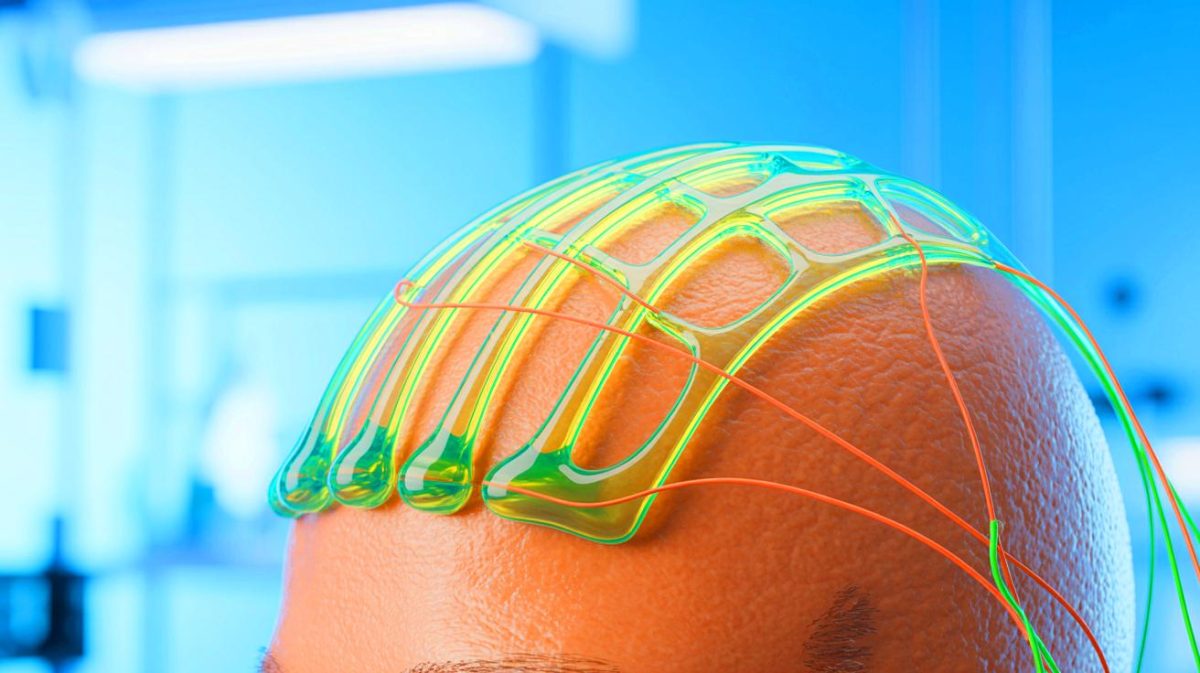 Illustration of a hair-thin EEG electrode made from 3D-printed hydrogel for advanced brain monitoring. Image generated by AI.