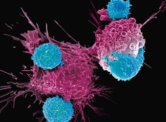La biotech française Mnemo lève 75 millions d’euros pour soigner le cancer